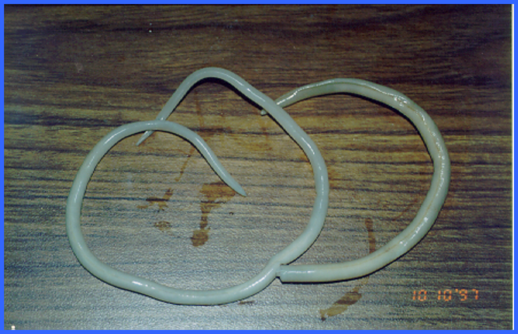 Intestinal Roundworm reference