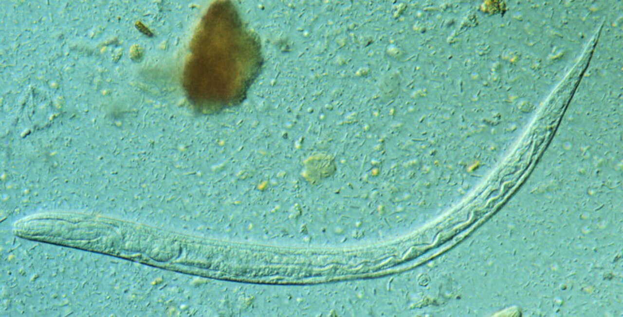 Strongyloides stercoralis reference