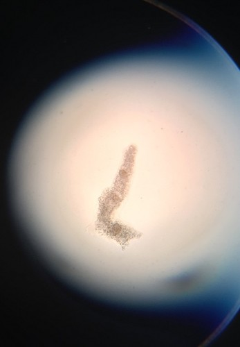 Common Amoeba reference
