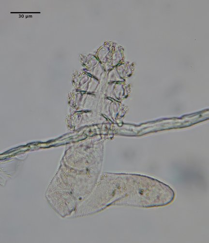Follicle Mite reference