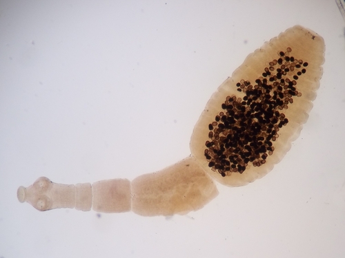Hydatid Tapeworm reference