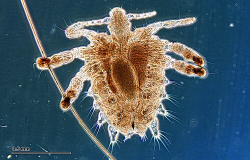 Crab Louse reference